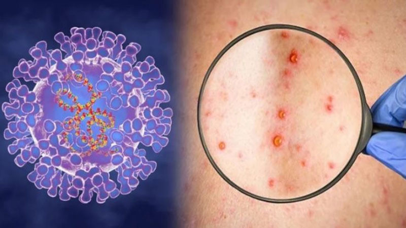 Foto ilustrativa. (Fotografía: Ministerio de Salud)