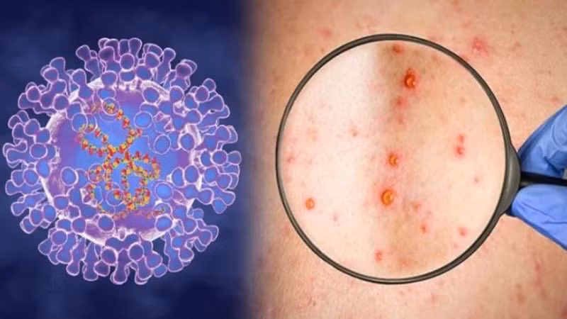 Foto ilustrativa. (Fotografía: Ministerio de Salud)