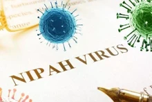 Foto de ilustración. (Foto: suckhoedoisong.vn)