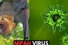 El virus Nipah, clasificado como enfermedad de alto riesgo, tiene una tasa de mortalidad alarmante que varía entre el 40 por ciento y el 75 por ciento. Actualmente no existen tratamientos específicos ni vacunas disponibles. (Foto: moh.gov.vn)