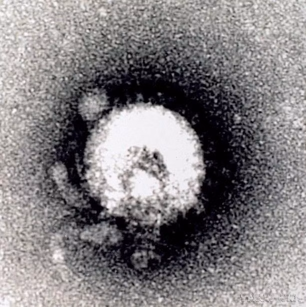 Vietnam ya es capaz de realizar pruebas y detectar todas las enfermedades infecciosas emergentes, incluidas la H5N1, el ébola y los nuevos coronavirus. En la foto: El Instituto Nacional de Higiene y Epidemiología capturó con éxito la estructura del virus H5N1 utilizando un microscopio electrónico JEM 1010 (2004). (Foto: VNA) Vietnam ya es capaz de realizar pruebas y detectar todas las enfermedades infecciosas emergentes, incluidas la H5N1, el ébola y los nuevos coronavirus. En la foto: El Instituto Nacional de Higiene y Epidemiología capturó con éxito la estructura del virus H5N1 utilizando un microscopio electrónico JEM 1010 (2004). (Foto: VNA)