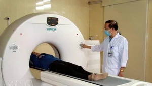 Vietnam fortalece la detección temprana de tuberculosis mediante chequeos periódicos. (Foto: VNA)