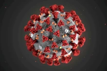 Virus SARS-CoV-2. (Fotografía: Reuters)