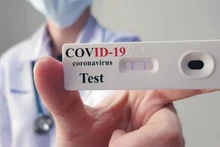 Ministerio de Salud Pública de Vietnam reajusta medidas de control de Covid-19
