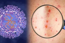 Foto ilustrativa. (Fotografía: Ministerio de Salud)