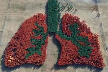 Filipinas establece récord mundial por imagen más grande del pulmón humano. (Fotografía: manilatimes.net)