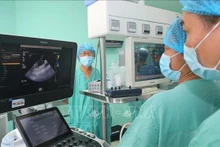 El equipo de médicos del Hospital Central de Hue dirige la realización de un trasplante de órganos procedentes de un donante con muerte cerebral en el Hospital Vietnam-Suecia en Uong Bi, provincia de Quang Ninh. (Fotografía: VNA)